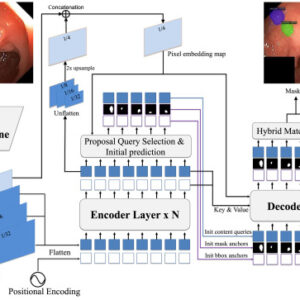 DYNAFormer: Enhancing transformer segmentation with dynamic anchor mask for medical imaging