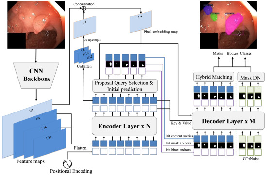 DYNAFormer: Enhancing transformer segmentation with dynamic anchor mask for medical imaging