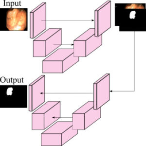 1-s2.0-S1361841524002329-gr5 Validating polyp and instrument segmentation methods in colonoscopy through Medico 2020 and MedAI 2021 Challenges